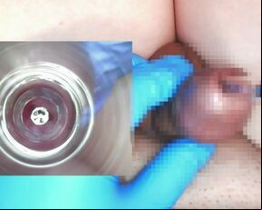 【閲覧注意】10mmの試験管に内視鏡を入れて尿道内の観察をしてみました。(主観視点＋内視鏡映像)